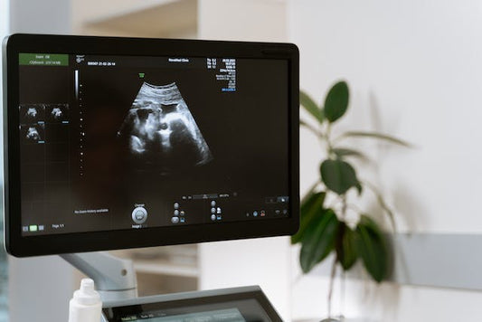 Are Ultrasounds Safe for Babies? What Parents Need to Know - ANB Baby